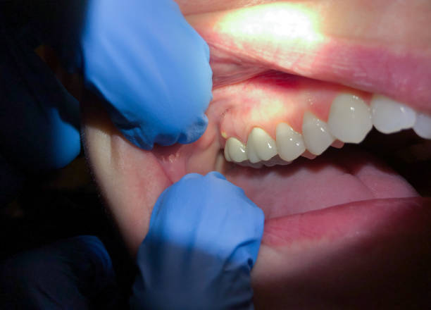 Best Dentist for Dental Trauma  in Springdale, NJ
